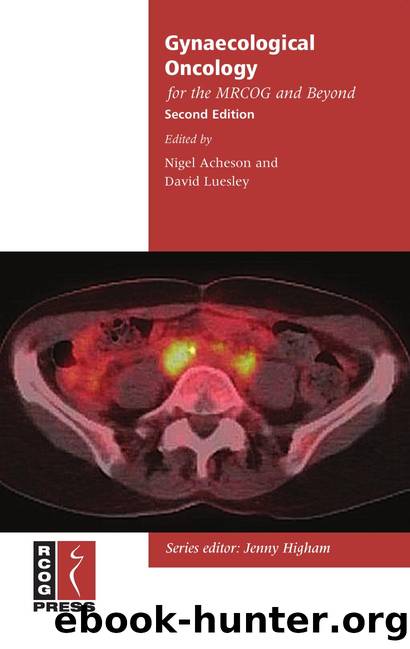 Gynaecological Oncology for the MRCOG and Beyond by Nigel Acheson; David Luesley