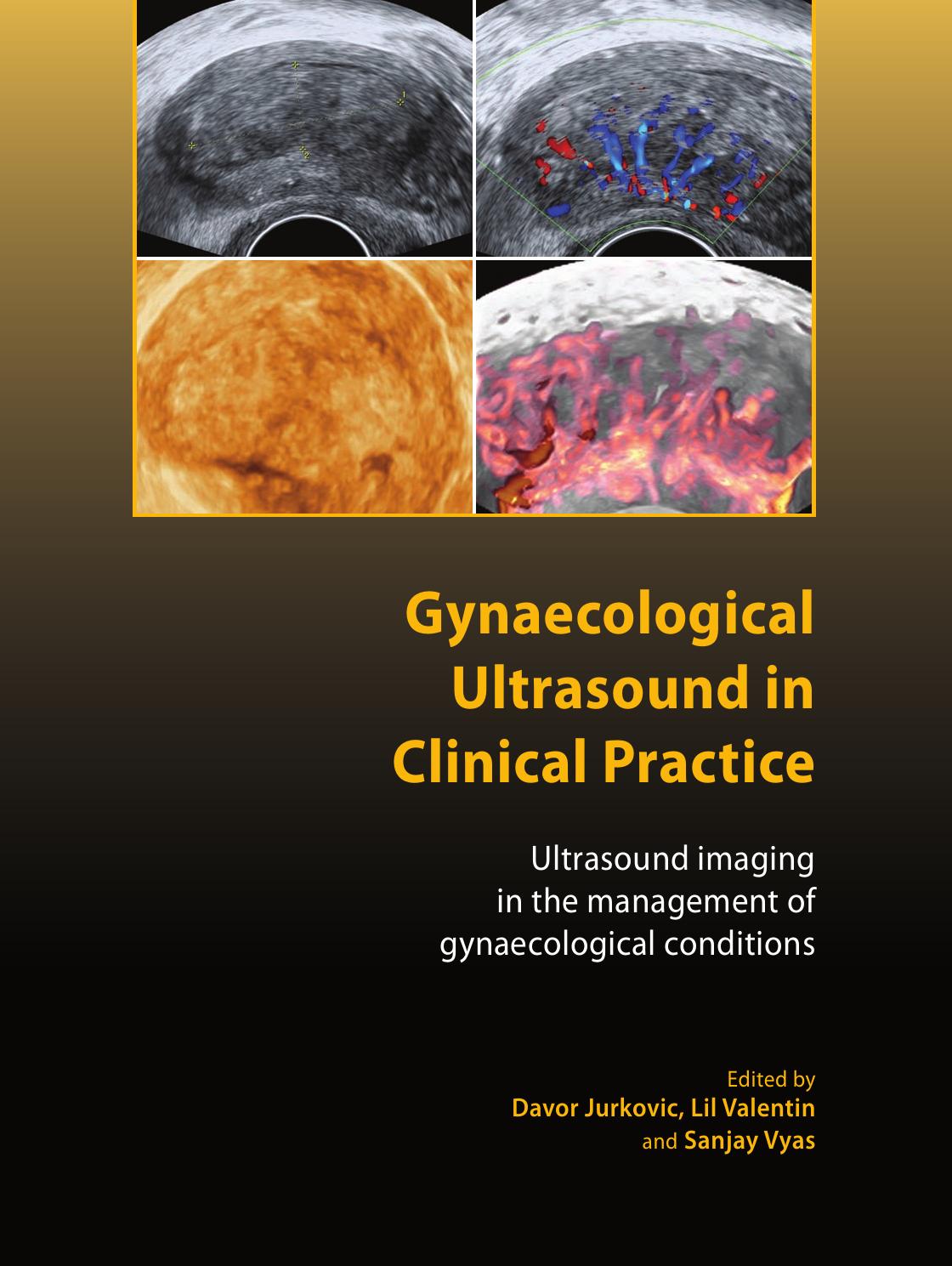 Gynaecological Ultrasound in Clinical Practice: Ultrasound Imaging in the Management of Gynaecological Conditions (Royal College of Obstetricians and Gynaecologists Advanced Skills) by Davor Jurkovic (editor) Lil Valentin (editor) Sanjay Vyas (editor)