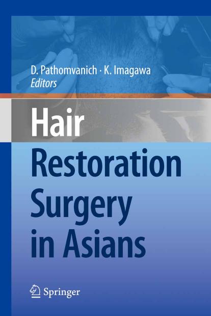 Hair Restoration Surgery in Asians by unknow