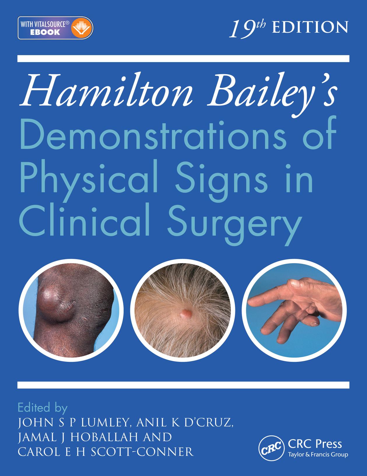 Hamilton Bailey's Physical Signs: Demonstrations of Physical Signs in Clinical Surgery by John S.P Lumley
