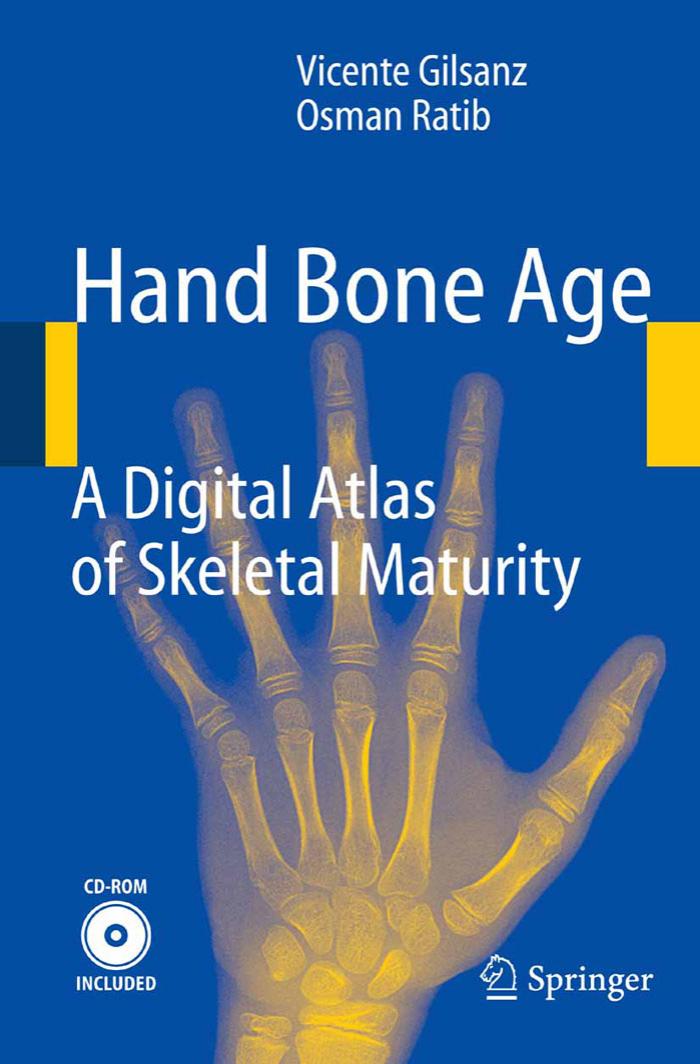 Hand Bone Age: A Digital Atlas of Skeletal Maturity by Vicente Gilsanz Osman Ratib