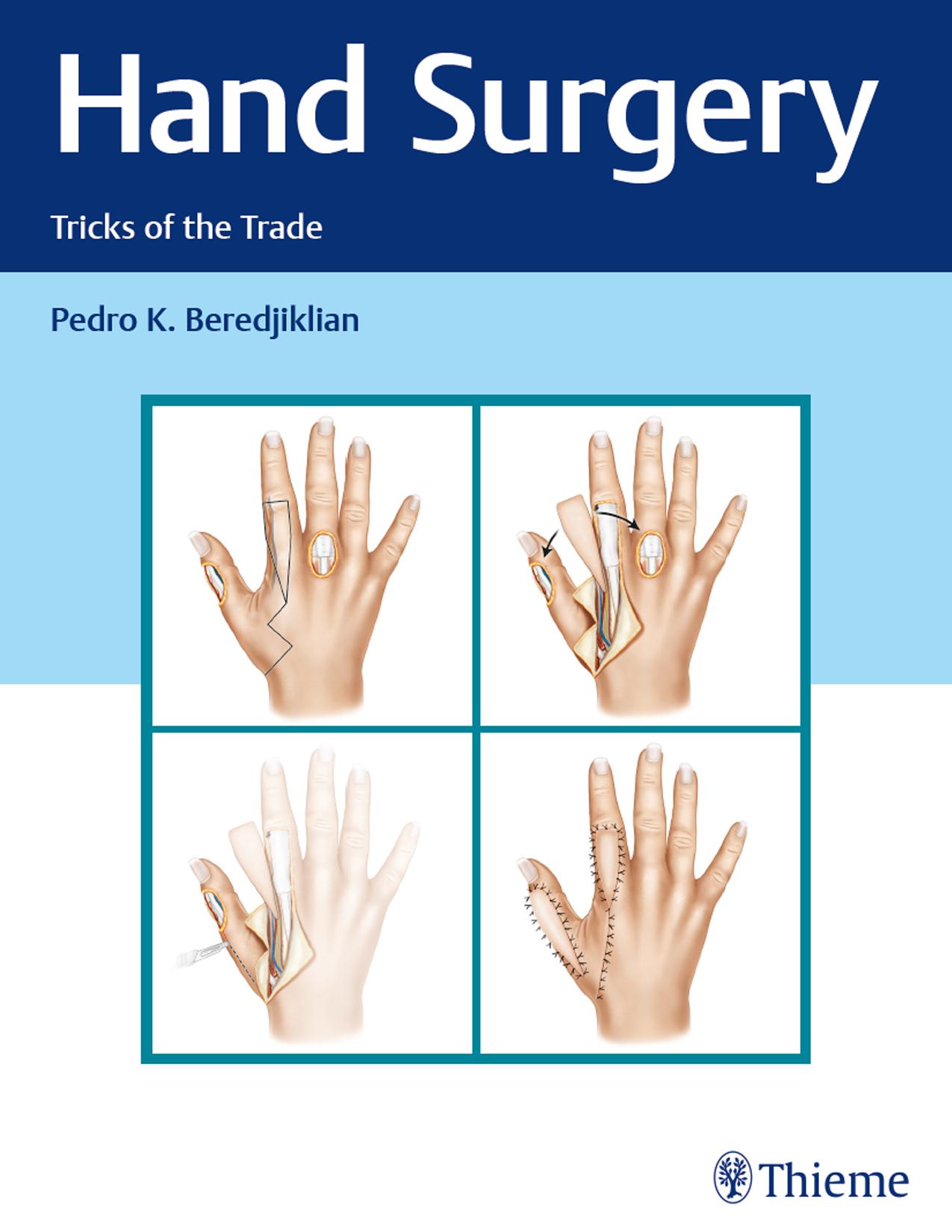 Hand Surgery: Tricks of the Trade by Pedro Beredjiklian