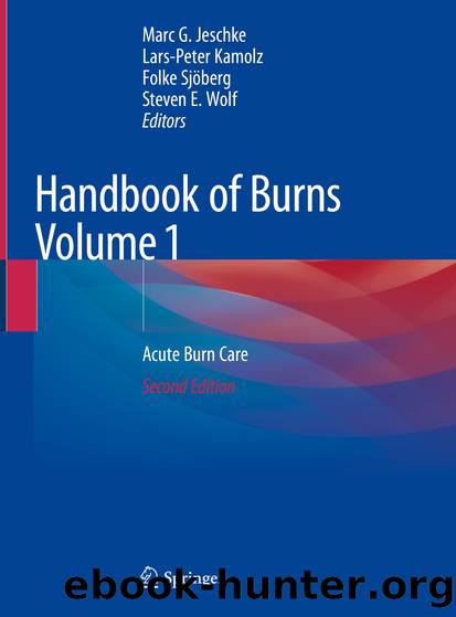 Handbook of Burns Volume 1 by Unknown