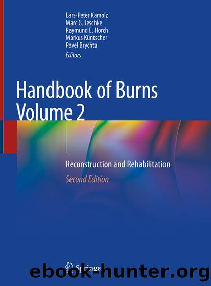 Handbook of Burns Volume 2 by Unknown