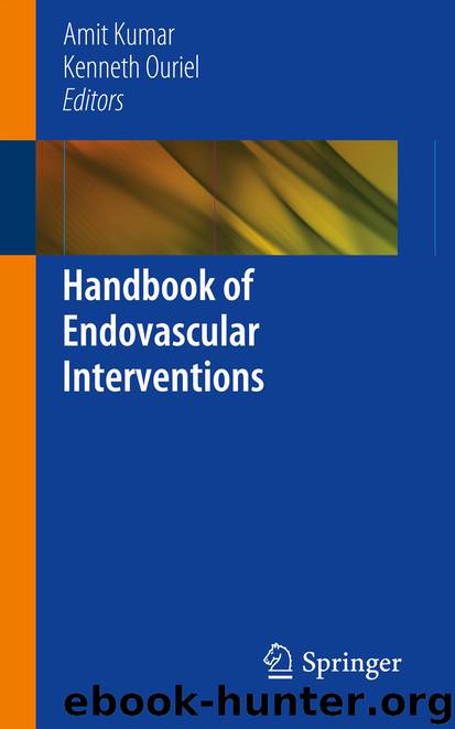 Handbook of Endovascular Interventions by Amit Kumar & Kenneth Ouriel