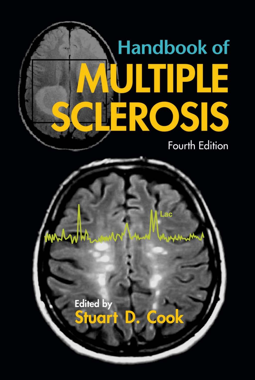 Handbook of Multiple Sclerosis by William A. Goddard III Donald Brenner Sergey Edward Lyshevski Gerald J Iafrate