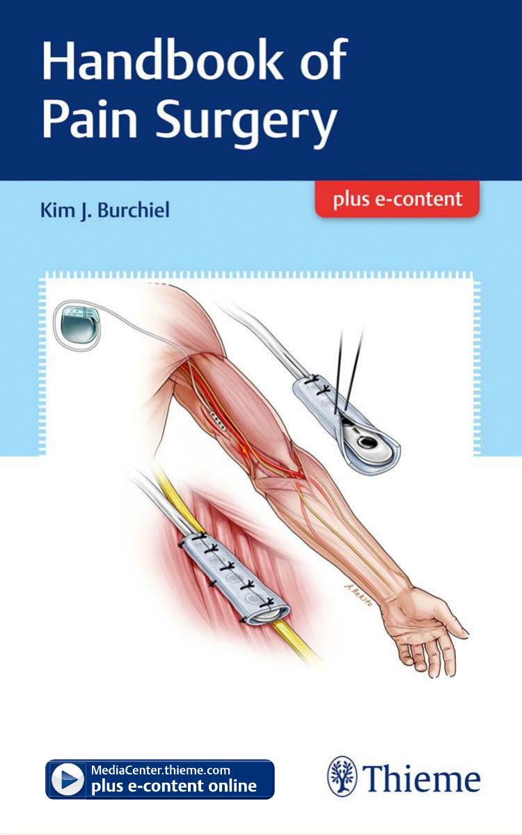 Handbook of Pain Surgery by Kim Burchiel