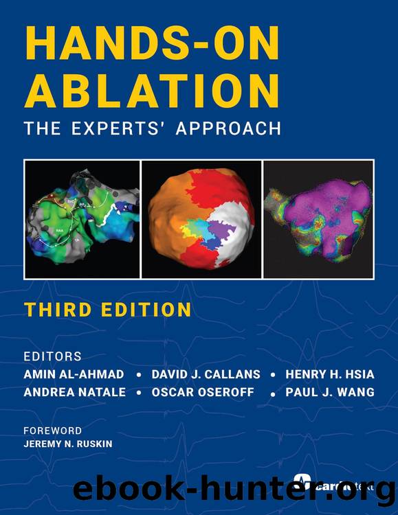 Hands-On Ablation, The Experts' Approach, Third Edition by Amin Al-Ahmad;David Callans;Henry H. Hsia;Andrea Natale;Oscar Oseroff;Paul J. Wang;