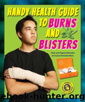 Handy Health Guide to Burns and Blisters by Alvin Silverstein
