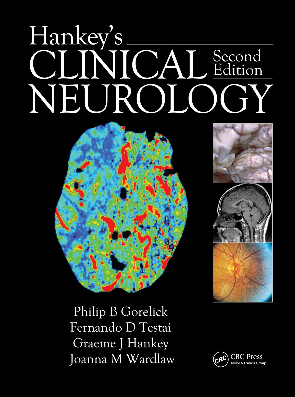 Hankey's Clinical Neurology, 2nd Ed [PDF][tahir99] VRG by Unknown