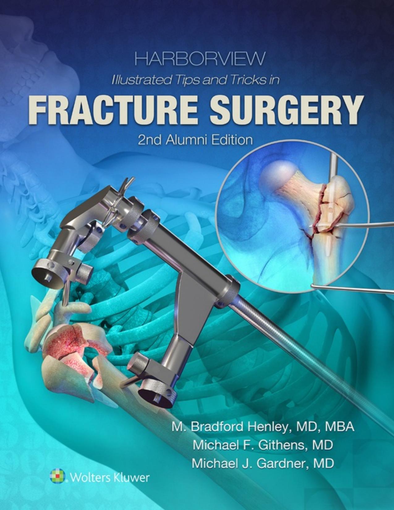 Harborview Illustrated Tips and Tricks in Fracture Surgery 2nd Edition by Unknow