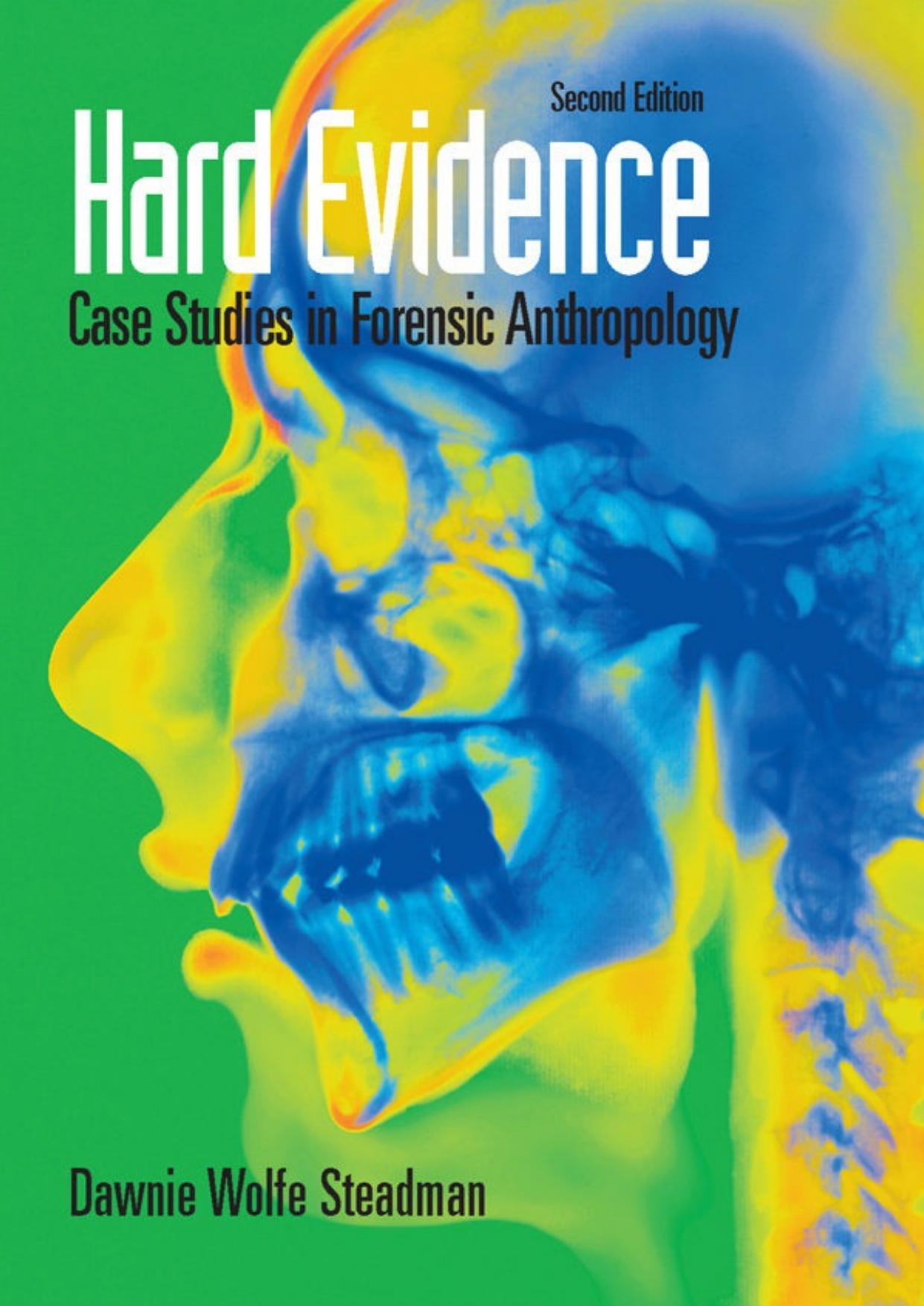Hard Evidence: Case Studies in Forensic Anthropology by Dawnie Wolfe Steadman