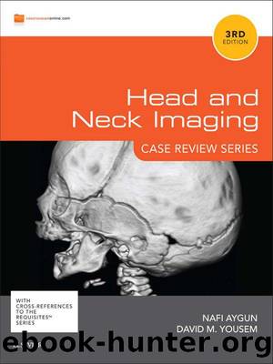 Head & Neck Imaging: Case Review Series by Aygun Nafi & Yousem David M