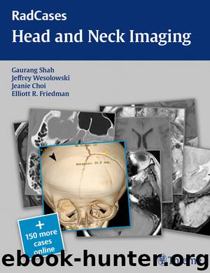Head and Neck Imaging by Gaurang Vrindavan Shah Jeffrey Robert Wesolowski Jeanie M. Choi
