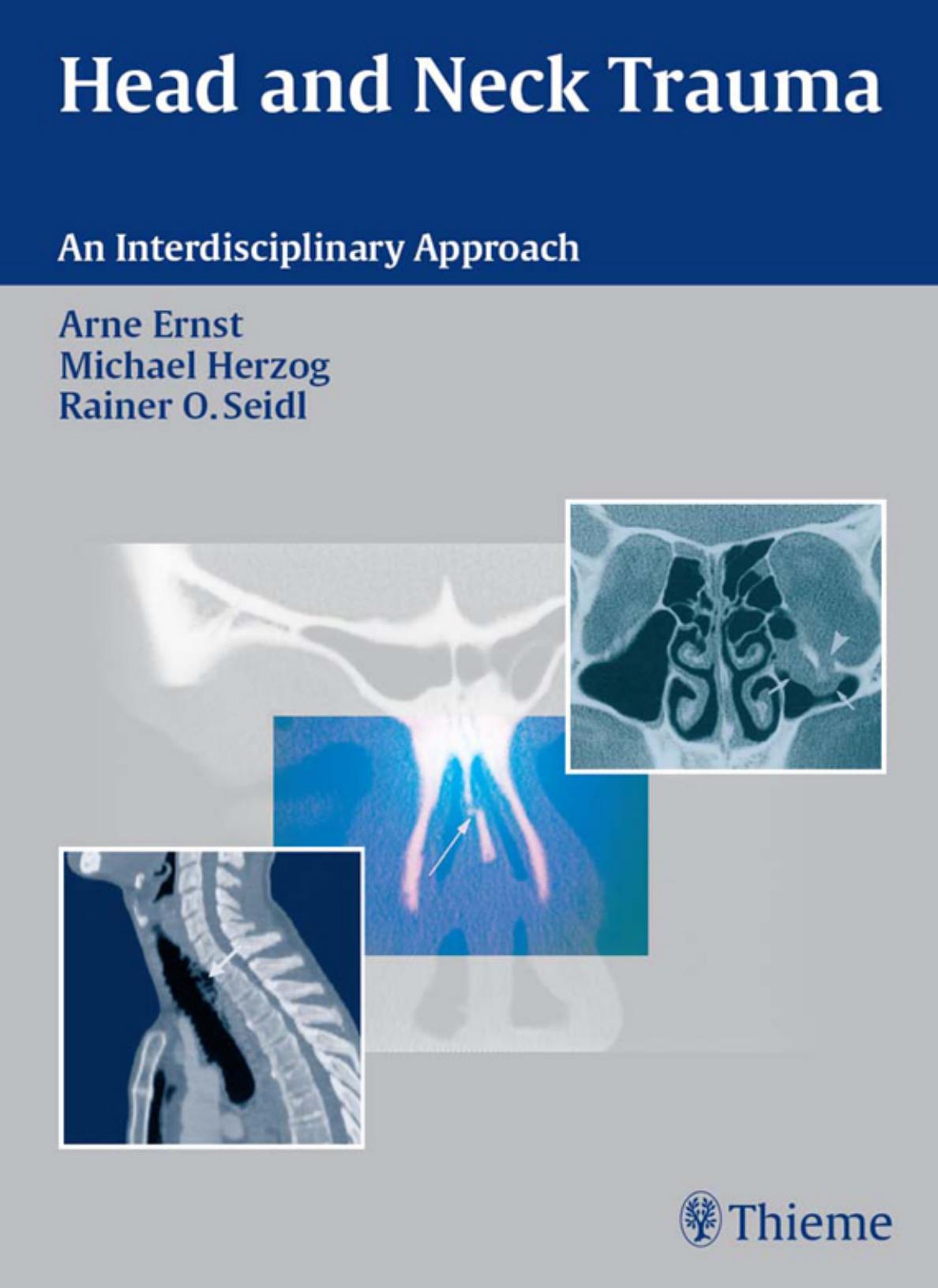 Head and Neck Trauma: An Interdisciplinary Approach by Michael Herzog and Rainer Ottis Seidl