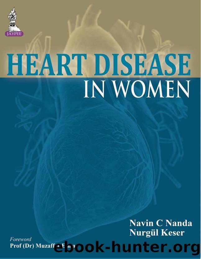 Heart Disease in Women by Nanda Navin C.;Keser Nurgül;