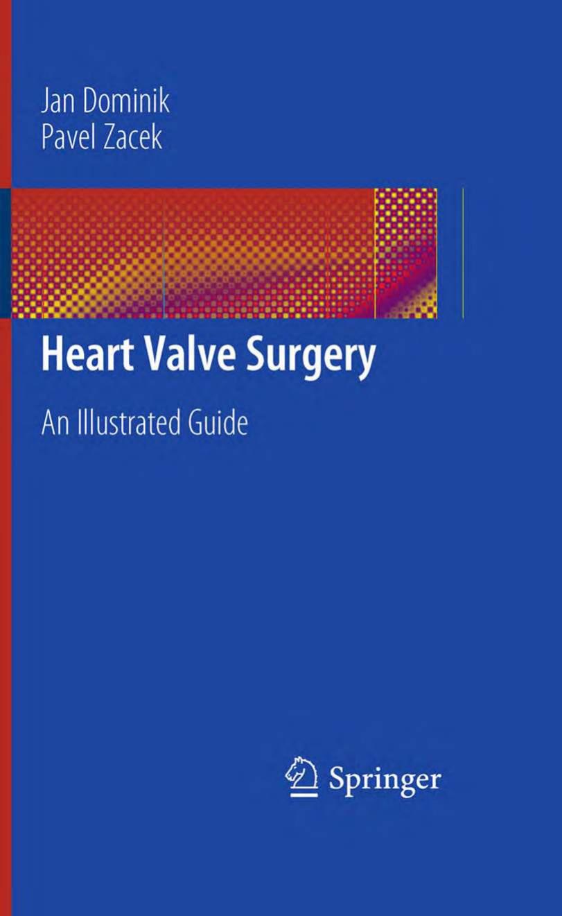 Heart Valve Surgery: An Illustrated Guide by Jan Dominik Pavel Zacek (auth.)
