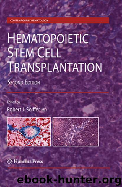 Hematopoietic Stem Cell Transplantation by Robert J. Soiffer