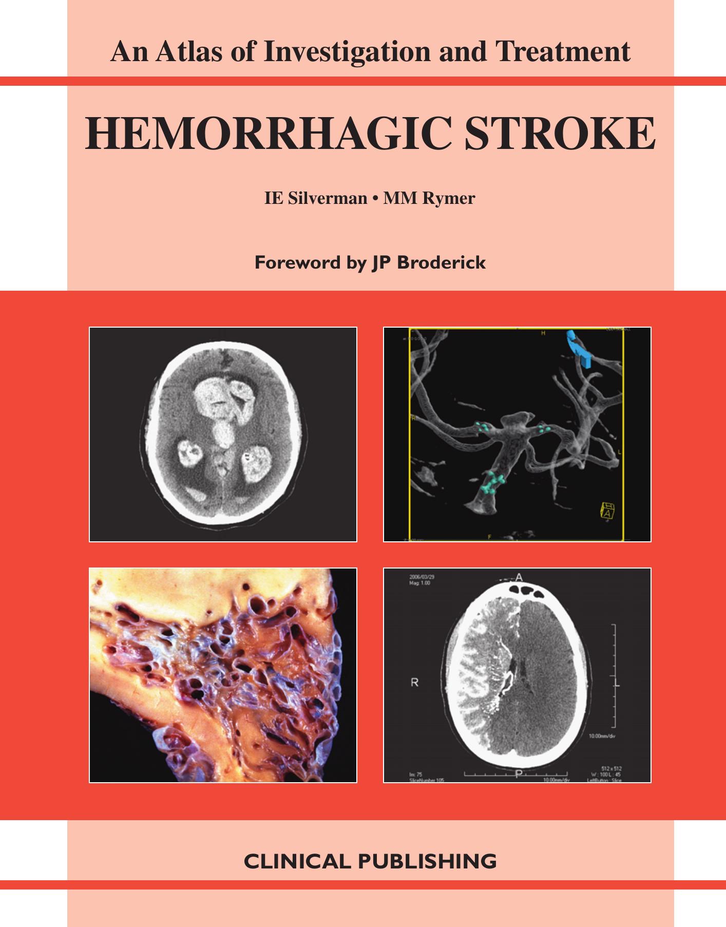 Hemorrhagic Stroke: An Atlas of Investigation and Treatment (Atlas of Assessment, Diagnosis and Management) by Isaac E. M.D. Silverman Marilyn M. M.D. Rymer