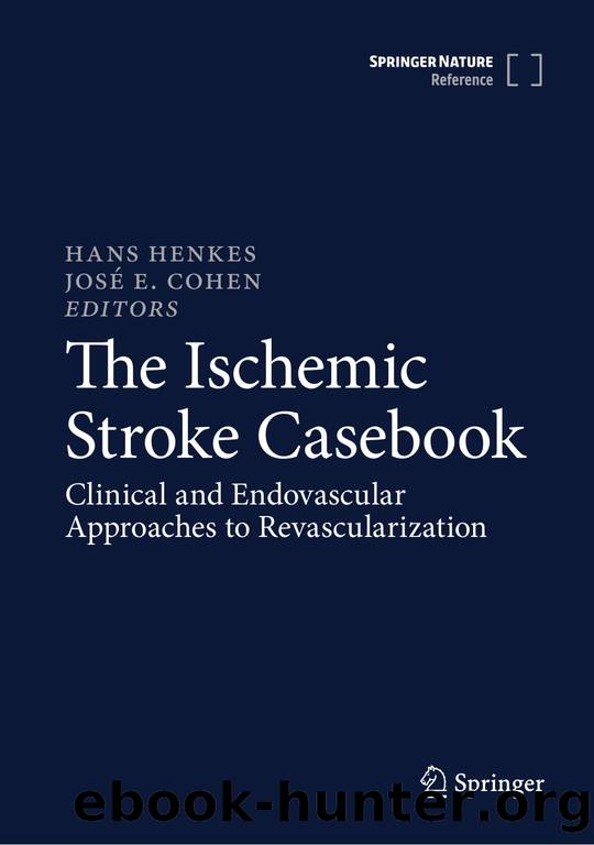 Henkes H. The Ischemic Stroke Casebook. Clinical and Endovascular Appr...2024 by Unknown