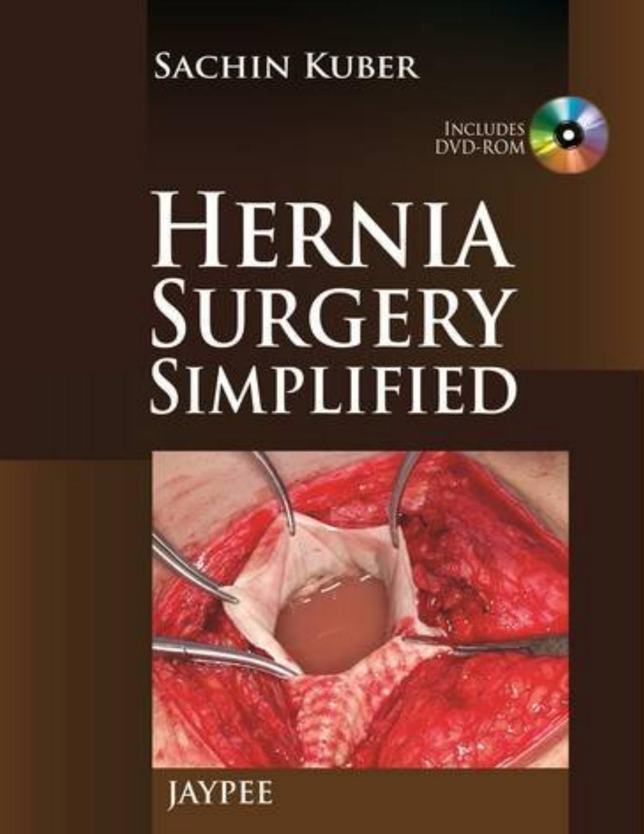 Hernia Surgery Simplified by Sachin Kuber