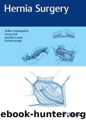 Hernia Surgery by Volker Schumpelick Georg Arlt Joachim Conze