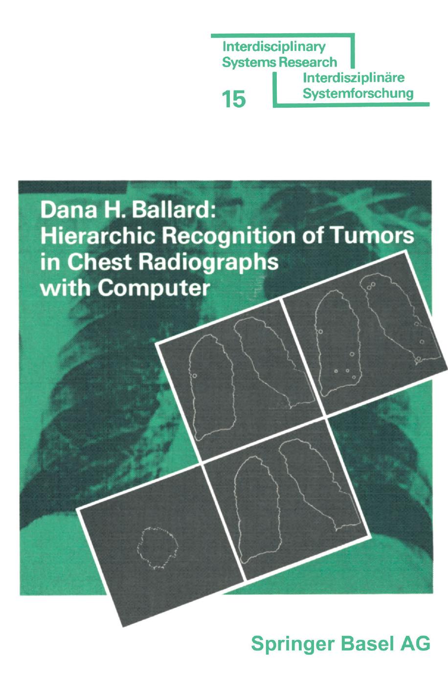 Hierarchic Recognition of Tumors in Chest Radiographs with Computer by Dana H. Ballard (auth.)