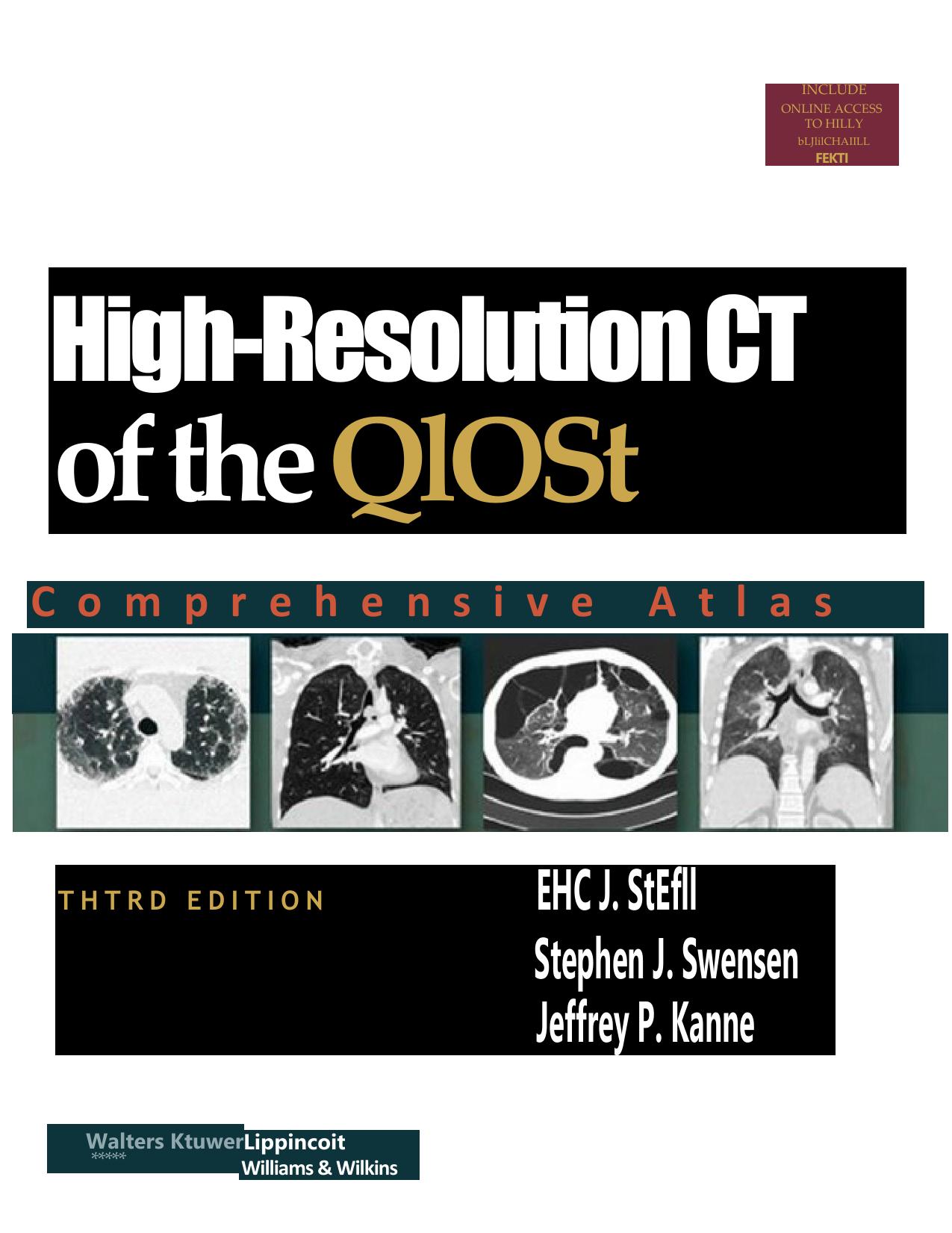 High-Resolution CT of the Chest: Comprehensive Atlas by Eric J. Stern; Stephen J. Swensen; Jeffrey P. Kanne