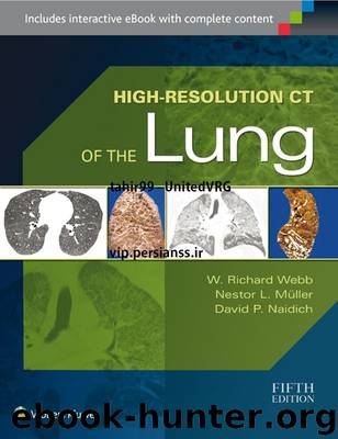 High-Resolution CT of the Lung by Webb W. Richard & Muller Nestor L. & Naidich David P