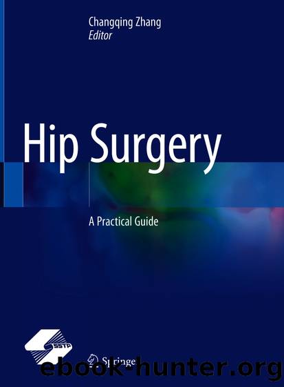 Hip Surgery by Unknown