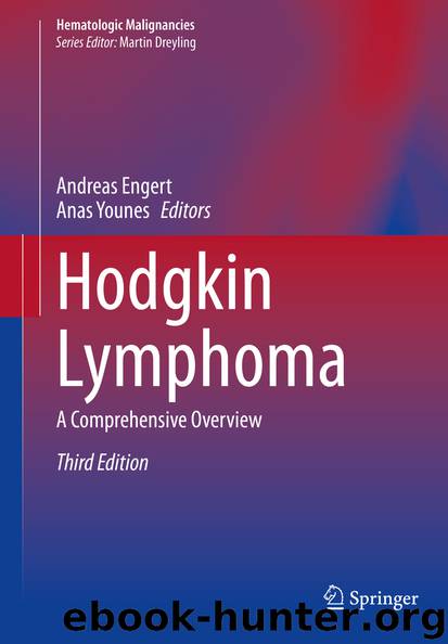 Hodgkin Lymphoma by Unknown