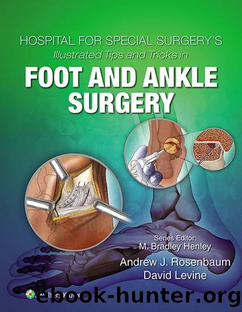 Hospital for Special Surgery's Illustrated Tips and Tricks in Foot and Ankle Surgery by David Levine; & David Levine