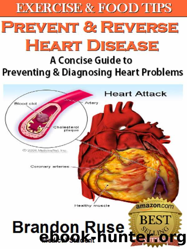 How To Prevent Heart Disease: A Concise Guide to Preventing & Diagnosing Heart Problems by Brandon Ruse