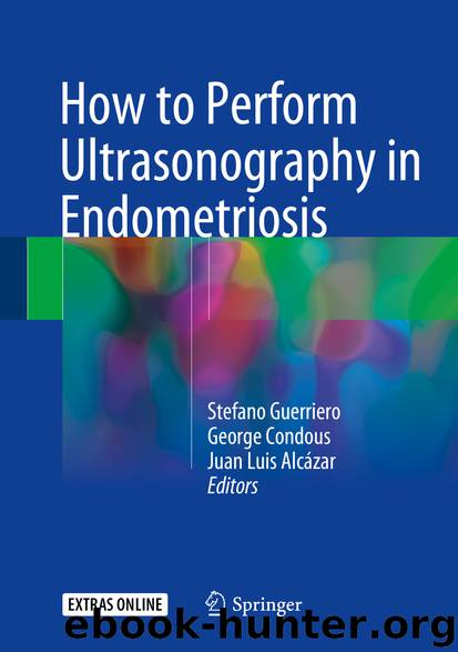 How to Perform Ultrasonography in Endometriosis by Stefano Guerriero & George Condous & Juan Luis Alcázar