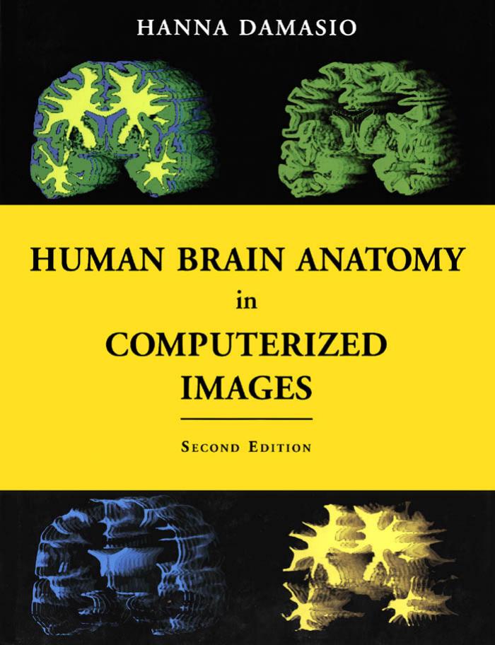 Human Brain Anatomy in Computerized Images by Hanna Damasio M.D