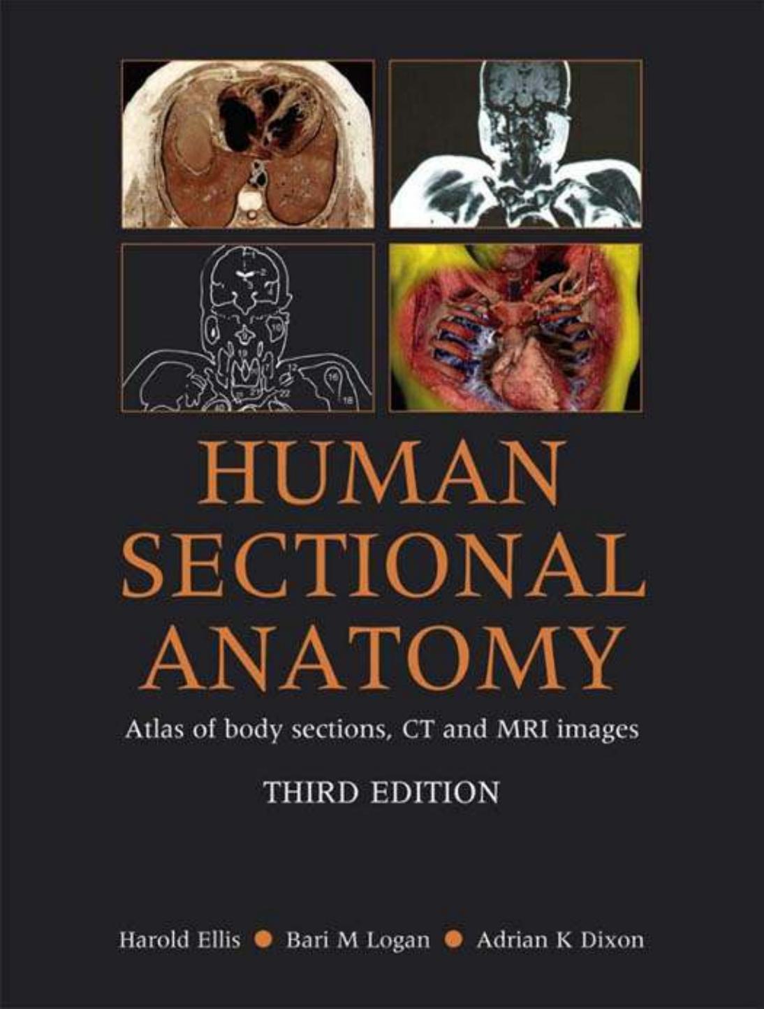 Human Sectional Anatomy: Atlas of Body Sections, CT and MRI Images (3rd Edition) (Repost) by Harold Ellis Bari M Logan Adrian K. Dixon