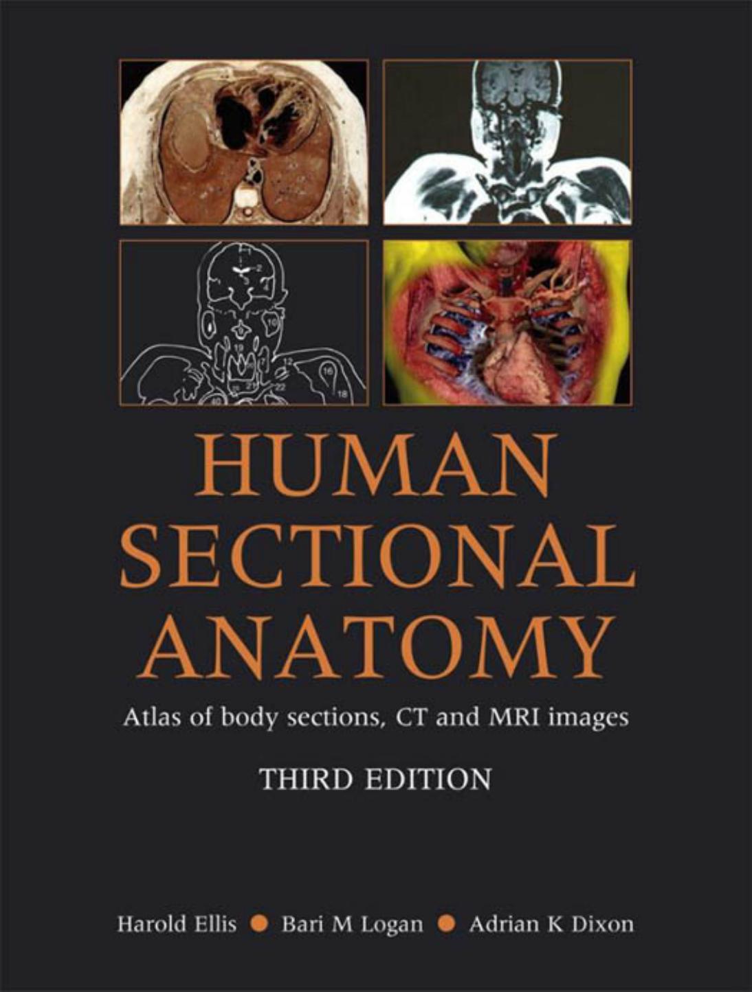 Human Sectional Anatomy: Atlas of Body Sections, CT and MRI Images - 3rd edition by Harold Ellis Bari M. Logan Adrian Dixon