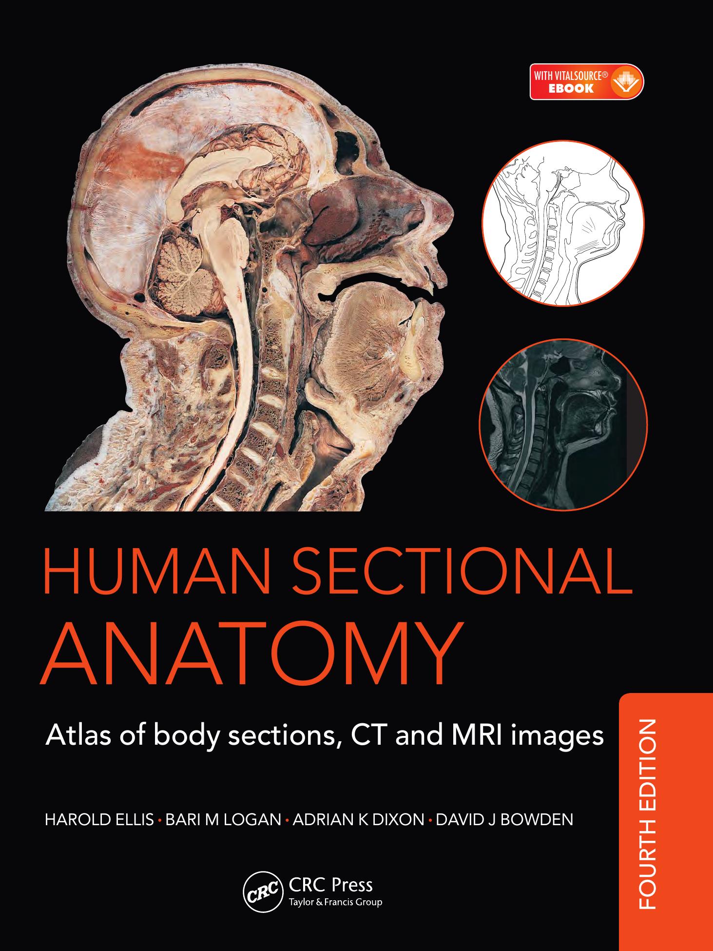 Human sectional anatomy : atlas of body sections, CT and MRI images by David J. Bowden; Harold Ellis; Adrian K. Dixon; B. M. Logan