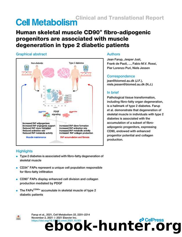 Human skeletal muscle CD90+ fibro-adipogenic progenitors are associated with muscle degeneration in type 2 diabetic patients by unknow