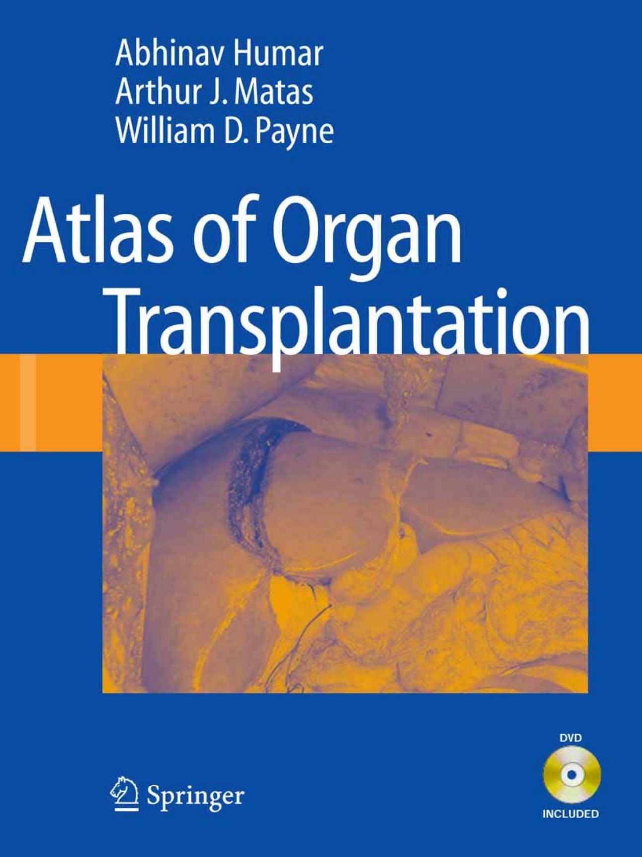 Humar Atlas of Organ Transplantation by Unknown