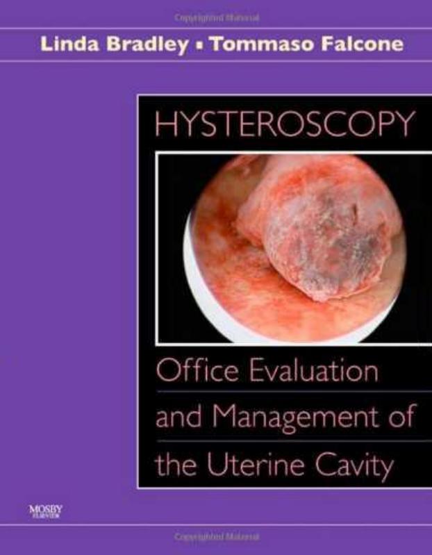 Hysteroscopy : office evaluation and management of the uterine cavity by Linda D Bradley; Tommaso Falcone