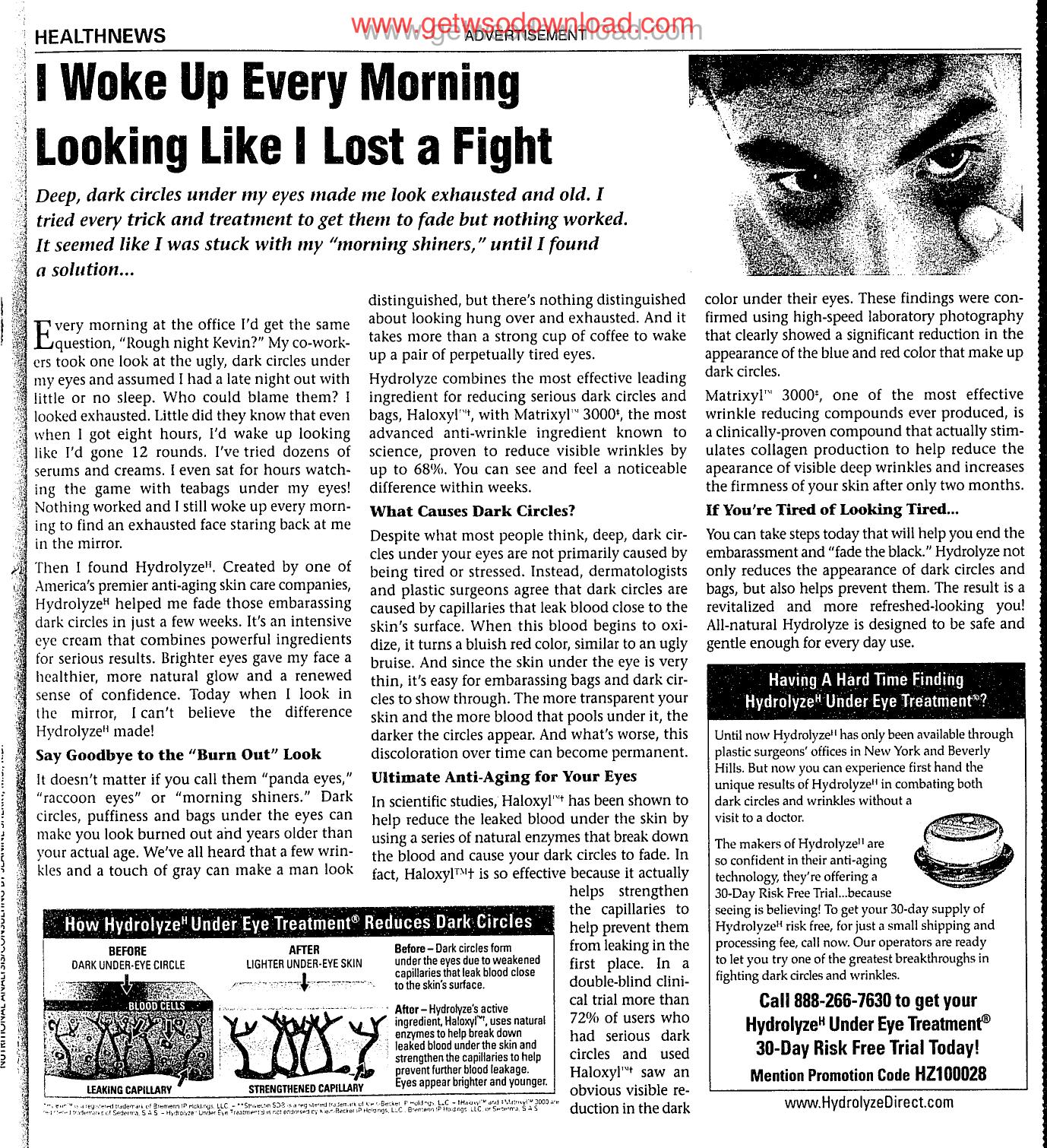 I woke up every morning looking like I lost a fight by Unknown