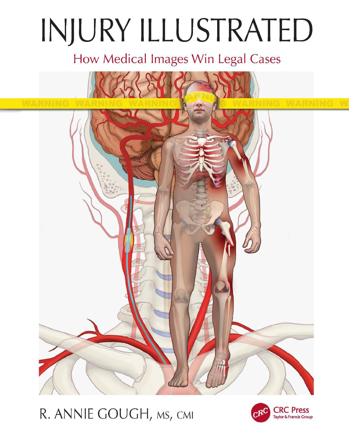 INJURY ILLUSTRATED; How Medical Images Win Legal Cases by R. Annie Gough