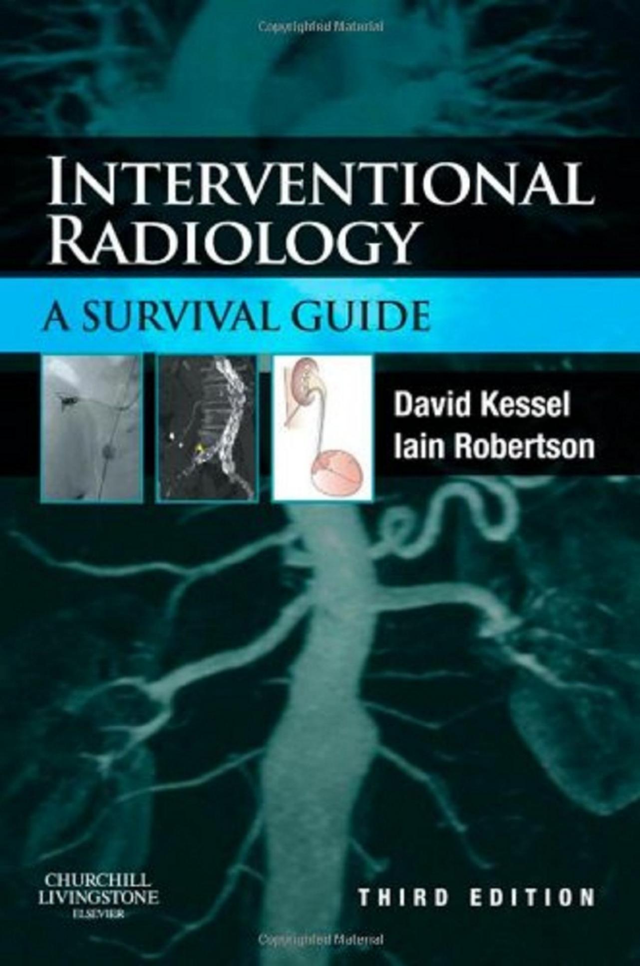 INTERVENT RADIOL: SURVIVAL GUIDE 3E by David Kessel