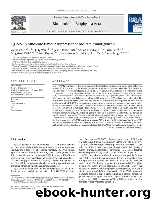 IQGAP2, A candidate tumour suppressor of prostate tumorigenesis by unknow