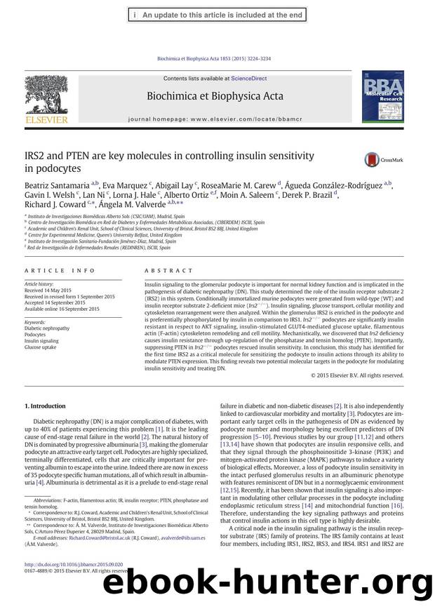 IRS2 and PTEN are key molecules in controlling insulin sensitivity in podocytes by unknow