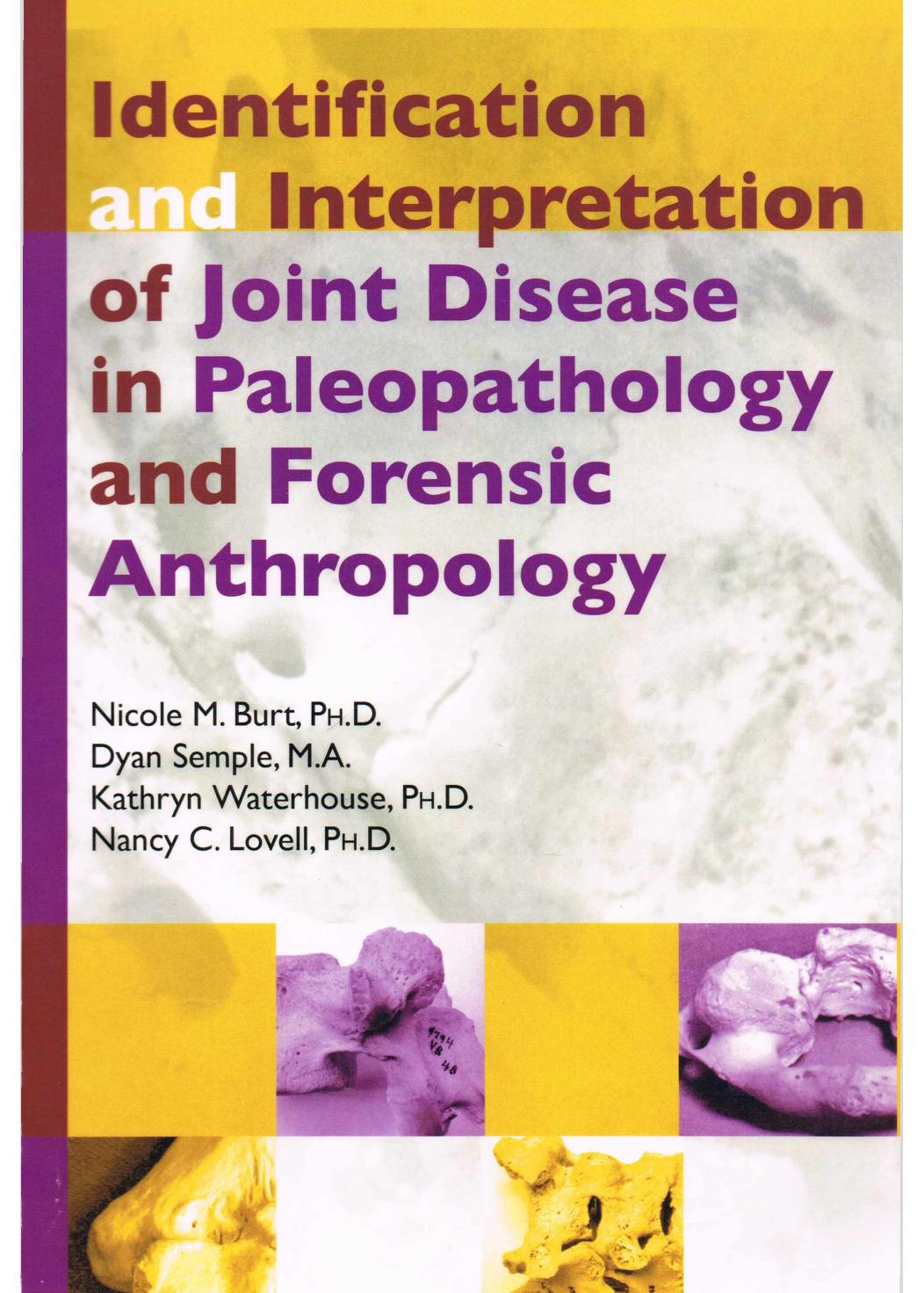 Identification and interpretation of joint disease in paleopathology and forensic anthropology by Nicole M. Burt Dyan Semple Kathryn Waterhouse Nancy C. Lovell