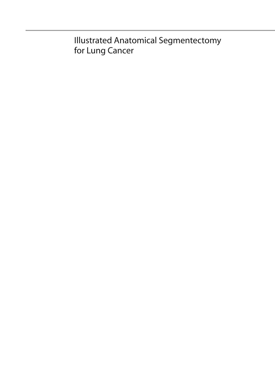 Illustrated Anatomical Segmentectomy for Lung Cancer by Hiroaki Nomori Morihito Okada (auth.)