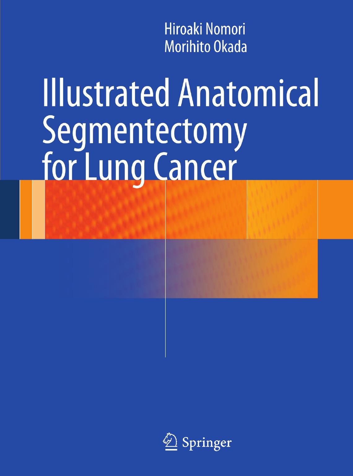 Illustrated Anatomical Segmentectomy for Lung Cancer by Unknow