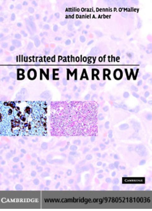 Illustrated Pathology of the Bone Marrow by Attilio Orazi Dennis P. O'Malley Daniel A. Arber
